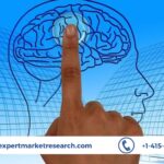 Neuronavigation Systems Market Trends