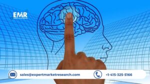 Neuronavigation Systems Market Trends