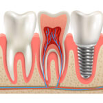 dental in san antonio tx