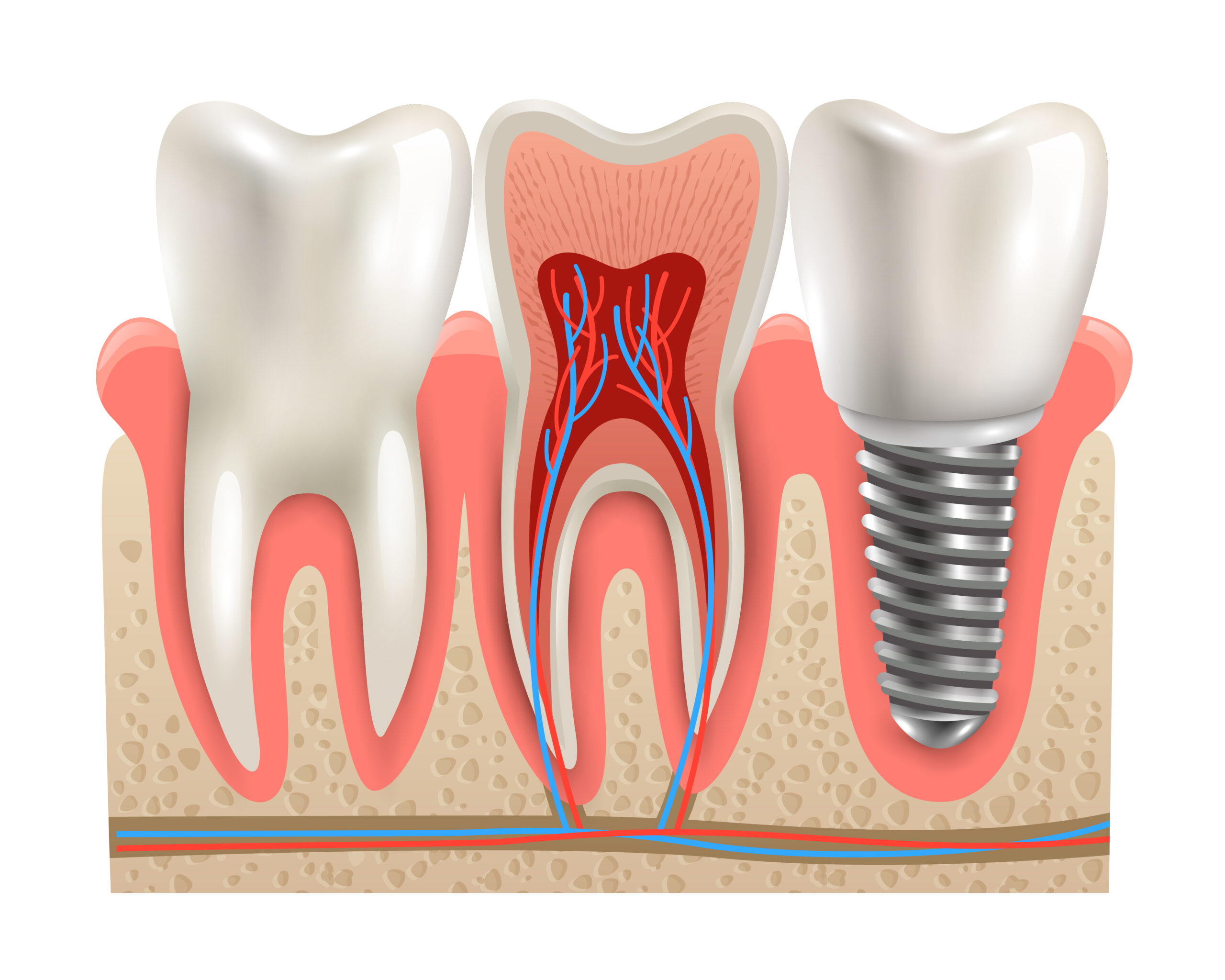 dental in san antonio tx